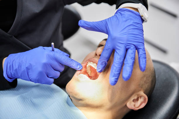Best Emergency Dentist for Knocked-Out Tooth in Fannett, TX